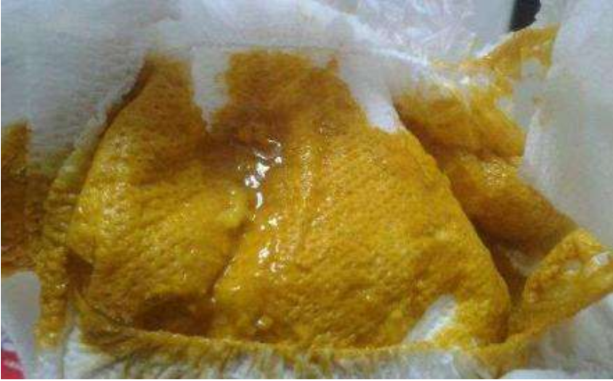 新生兒大便什么顏色正常 新生兒大便顏色異常怎么辦 新生兒大便什么顏色正常 新生兒大便顏色異常怎么辦