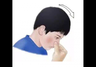 寶寶流鼻血就是上火嗎 一定不要搞錯了