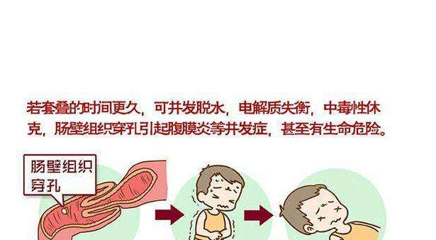 寶寶得了腸套疊會怎么樣 寶寶腸套疊會自己好嗎