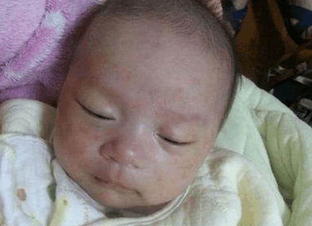 什么樣的媽媽更容易懷胎毒寶寶 如何預防寶寶胎毒