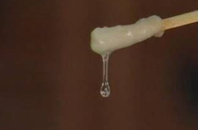 女性白帶拉絲說明什么 白帶拉絲是在排卵前還是排卵后