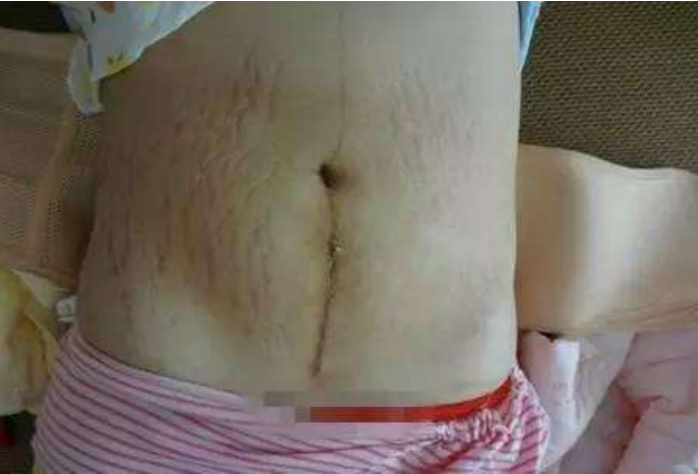 怎么看生沒過生孩子 從哪個部位可以看出來