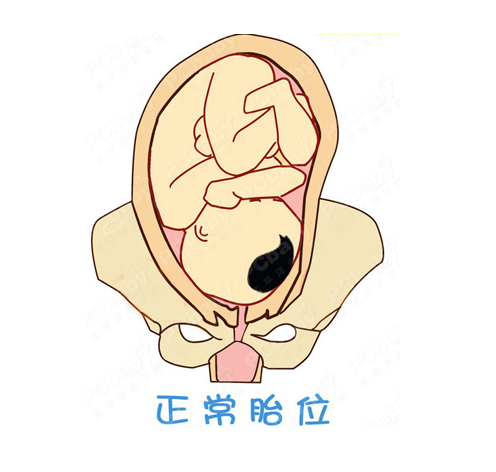 什么是胎位不正 胎位不正的原因是什么