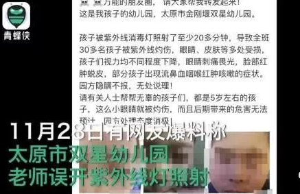 太原市雙星幼兒園紫外線燈灼傷孩子眼睛 家用紫外線對孩子有影響嗎