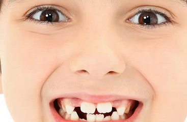 寶寶從什么時候開始換牙 換牙期間要注意什么