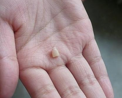 寶寶從什么時候開始換牙 換牙期間要注意什么