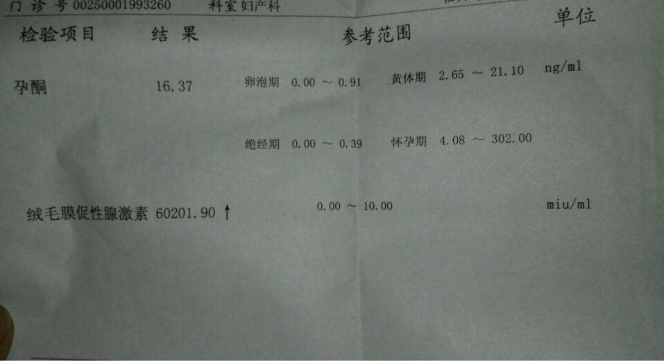 懷孕多久可以抽血驗孕 抽血驗孕化驗單怎么看