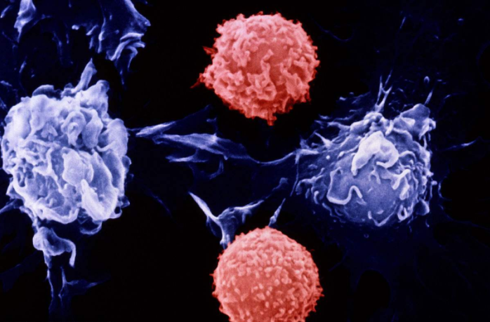 奇葩說邱晨患癌是怎么回事 奇葩說邱晨自爆患有淋巴結