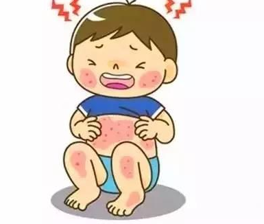 痱子和濕疹的區(qū)別 如何防治痱子和濕疹 痱子和濕疹的區(qū)別 如何防治痱子和濕疹