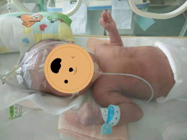 新生兒呼吸急促是什么原因 新生兒呼吸急促判斷方法 新生兒呼吸急促是什么原因 新生兒呼吸急促判斷方法