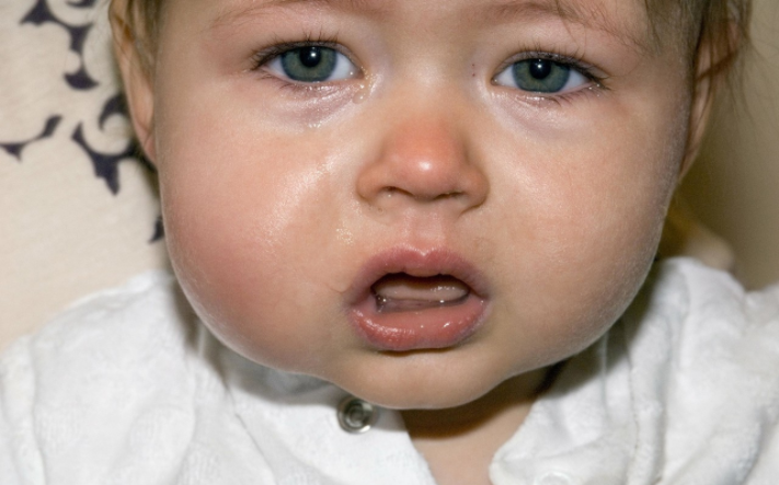 寶寶臉腫脹是得了流行性腮腺炎嗎 寶寶得流行性腮腺炎有什么癥狀 寶寶臉腫脹是得了流行性腮腺炎嗎 寶寶得流行性腮腺炎有什么癥狀