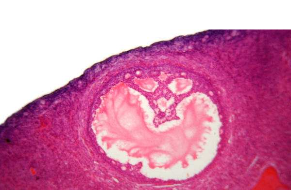 如何判斷子宮內膜薄 子宮內膜薄怎么調理好