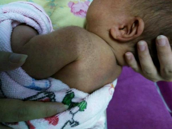 寶寶身上搓出來的黑刺是什么 寶寶身上的黑刺是胎毒嗎 寶寶身上搓出來的黑刺是什么 寶寶身上的黑刺是胎毒嗎