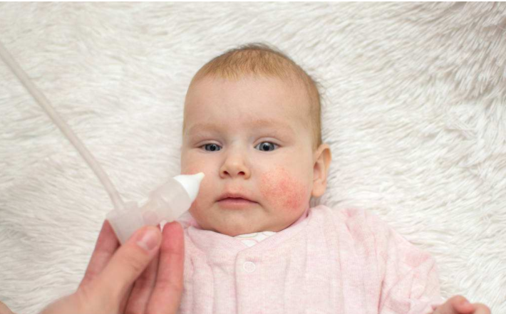 冬季寶寶容易長濕疹怎么辦 冬季寶寶長濕疹常見原因