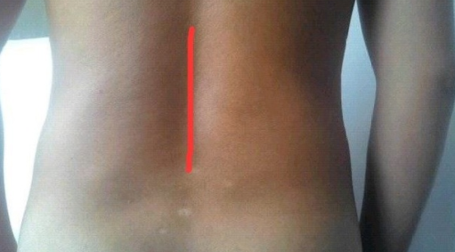 開十指怎么緩解疼痛 快速開宮口方法 開十指怎么緩解疼痛 快速開宮口方法