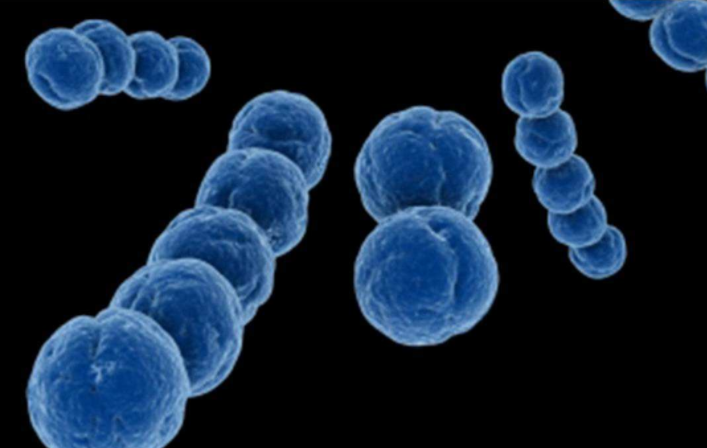 女性尿道炎疼痛是怎么回事 得了尿道炎怎么辦