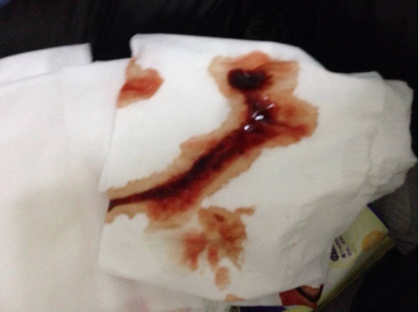 產后惡露多久會干凈 產后惡露怎么排干凈