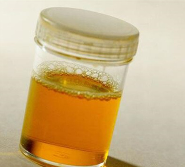 孕婦尿黃生男孩嗎 孕婦尿液發黃怎么辦 孕婦尿黃生男孩嗎 孕婦尿液發黃怎么辦