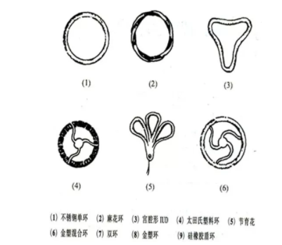 節(jié)育環(huán)有哪些類(lèi)型 國(guó)內(nèi)外節(jié)育環(huán)種類(lèi)介紹 節(jié)育環(huán)有哪些類(lèi)型 國(guó)內(nèi)外節(jié)育環(huán)種類(lèi)介紹