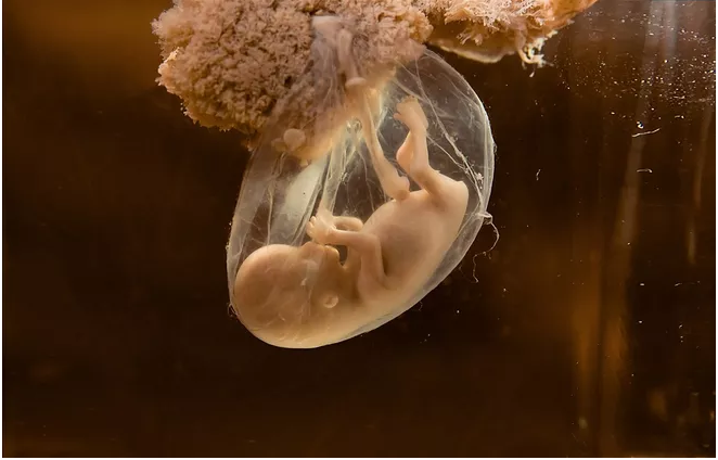 羊水渾濁孕婦有感覺嗎 孕婦羊水渾濁怎么辦