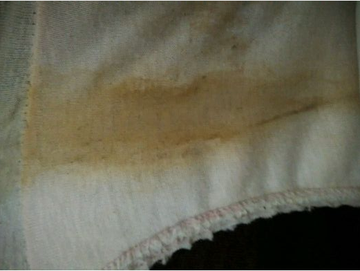 孕期內(nèi)褲總是濕的怎么回事 孕期內(nèi)褲濕是羊水嗎