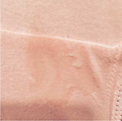 孕期內(nèi)褲總是濕的怎么回事 孕期內(nèi)褲濕是羊水嗎