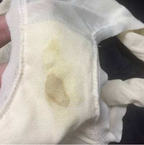 孕期內(nèi)褲總是濕的怎么回事 孕期內(nèi)褲濕是羊水嗎