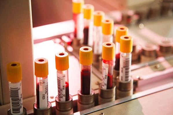 新生兒溶血病嚴(yán)重嗎 得了新生兒溶血病怎么治療 新生兒溶血病嚴(yán)重嗎 得了新生兒溶血病怎么治療