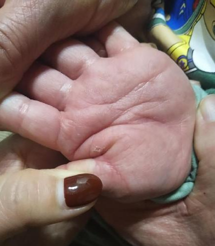 寶寶吃哪些東西最容易過敏 避免孩子過敏有什么方法 寶寶吃哪些東西最容易過敏 避免孩子過敏有什么方法