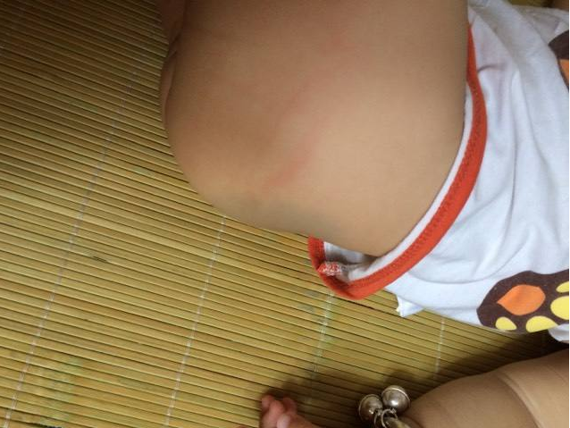 孩子犯錯(cuò)了該打嗎 孩子什么部位不能打