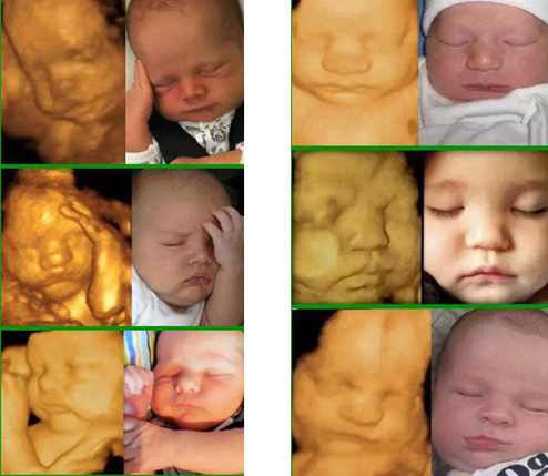 四維彩超在幾周做最好 做四維彩超的最佳時(shí)間