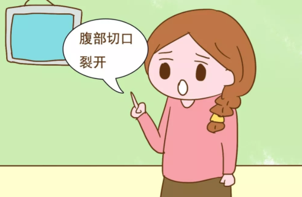 產后束腹帶有什么用 束縛帶的作用介紹