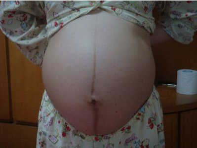 孕肚有的圓有的尖是怎么回事 孕肚看生男生女靠譜嗎