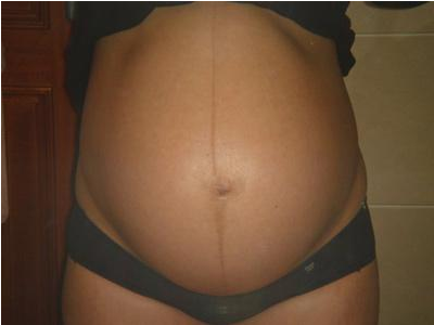 孕肚有的圓有的尖是怎么回事 孕肚看生男生女靠譜嗎