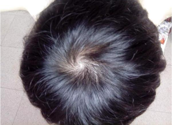 孩子頭旋越多越聰明嗎 孩子頭上的發旋有什么說法