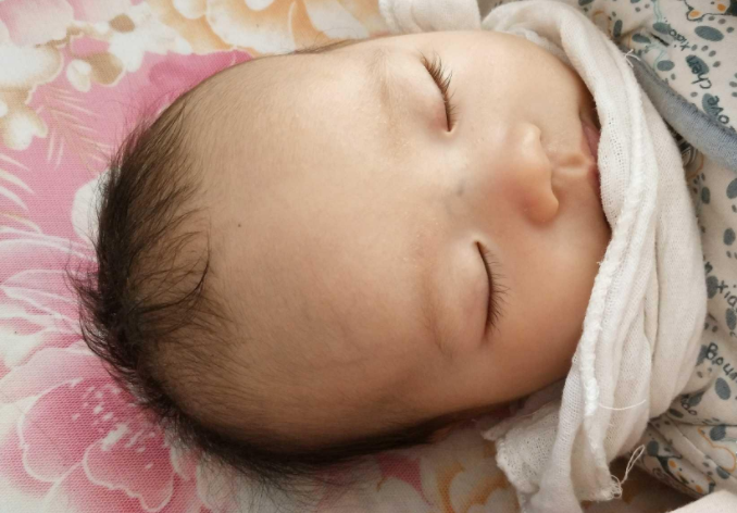 寶寶鼻梁發(fā)青是積食嗎 寶寶鼻梁出現(xiàn)青筋怎么護(hù)理 寶寶鼻梁發(fā)青是積食嗎 寶寶鼻梁出現(xiàn)青筋怎么護(hù)理