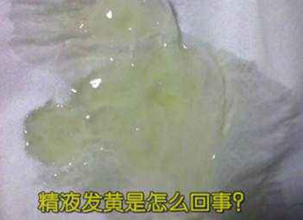 男性精液發黃正常嗎 男性精液發黃有什么危害 男性精液發黃正常嗎 男性精液發黃有什么危害