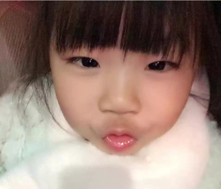 寶寶鼻梁發青是積食嗎 寶寶鼻梁出現青筋怎么護理