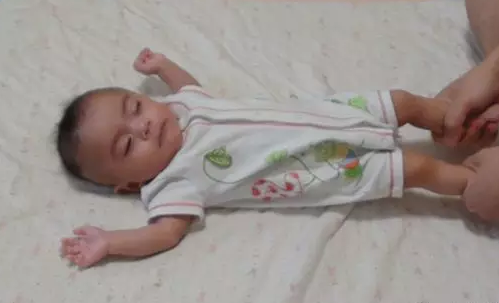 寶寶肌張力低怎么訓練 肌張力低恢復訓練方法 寶寶肌張力低怎么訓練 肌張力低恢復訓練方法