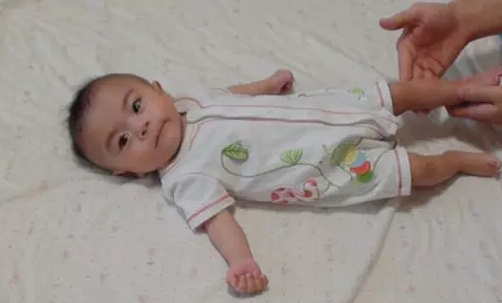 寶寶肌張力低怎么訓練 肌張力低恢復訓練方法 寶寶肌張力低怎么訓練 肌張力低恢復訓練方法