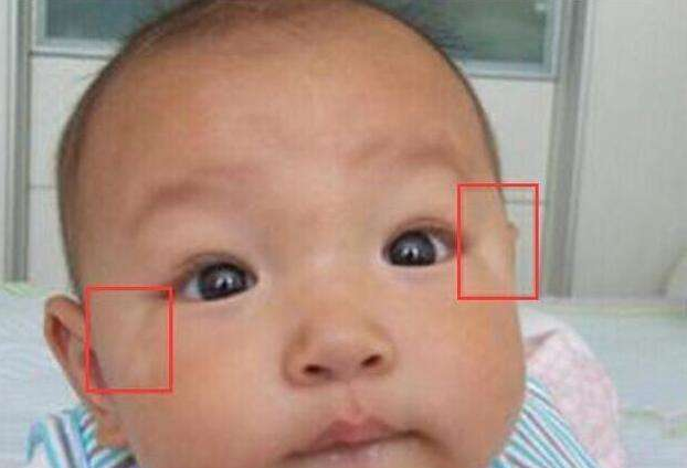 寶寶肚子里長蛔蟲有什么癥狀 小孩吃什么蛔蟲藥效果好