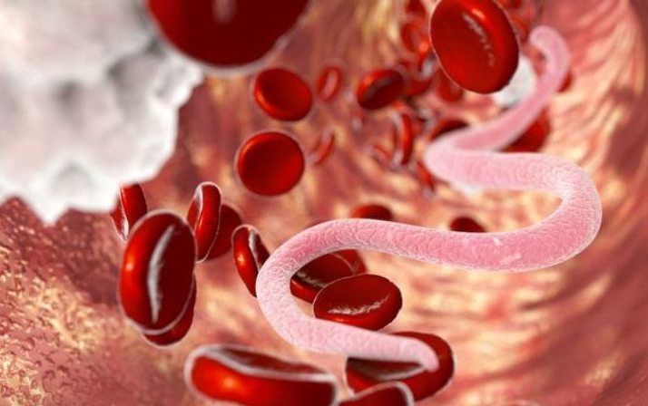 寶寶肚子里長蛔蟲有什么癥狀 小孩吃什么蛔蟲藥效果好