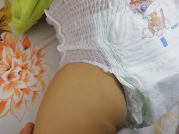 柔愛拉拉褲會不會紅屁屁  柔愛拉拉褲穿起來感受如何