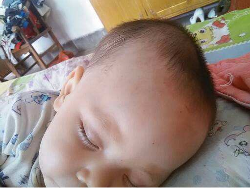 寶寶頭大更聰明嗎 寶寶額頭高怎么辦