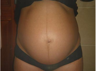 懷孕多久肚子會隆起 孕肚兩邊大小不一樣是怎么回事 懷孕多久肚子會隆起 孕肚兩邊大小不一樣是怎么回事