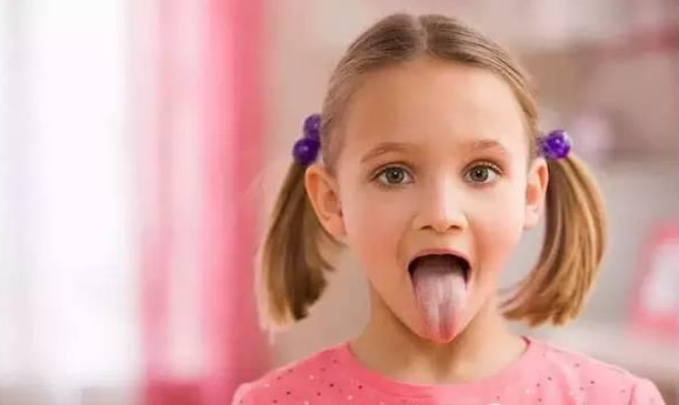 寶寶出現地圖舌是什么原因引起的 寶寶地圖舌怎么緩解