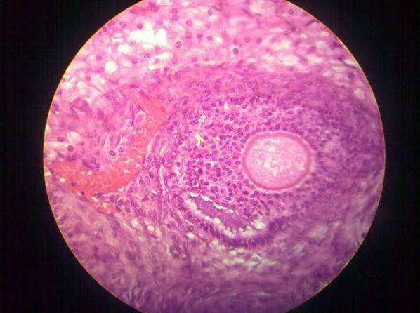 怎么看卵泡質量好不好 卵泡質量好有什么標準