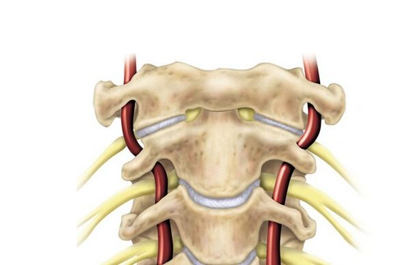骨癌有什么癥狀 青少年容易得骨癌是什么原因