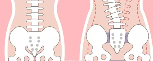 產后屁股變大是怎么回事 產后屁股變大的原因