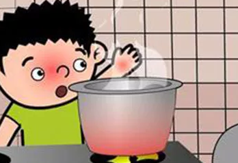 寶寶被開(kāi)水燙怎么辦 寶寶被開(kāi)水燙可以用牙膏嗎